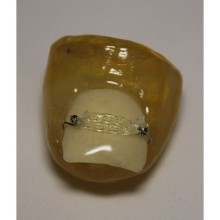 Oniko Tırnak Gevşetici Tel