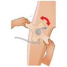 Kasık Kapama Pedi Angio Pad Anjiyo Ped
